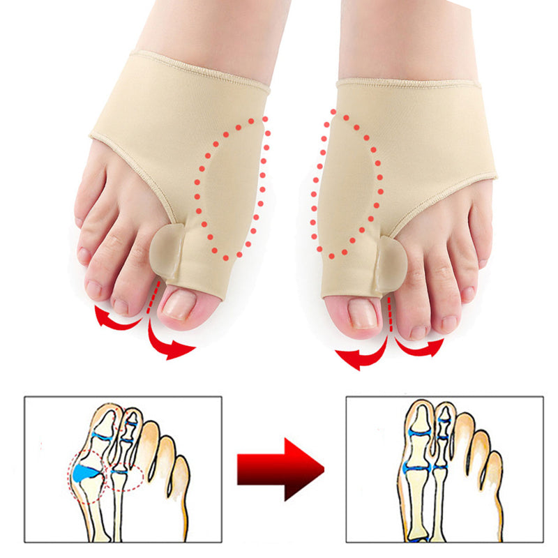 Orthopädische Ballenkorrektur 1 Paar (links + rechts) bei Polyneuropathie in den Füßen & Hallux Valgus