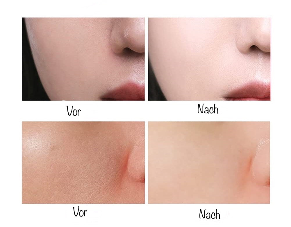 (1+1 GRATIS) Skin Care Gel -  Gesichtsgrundierung für unsichtbare Poren