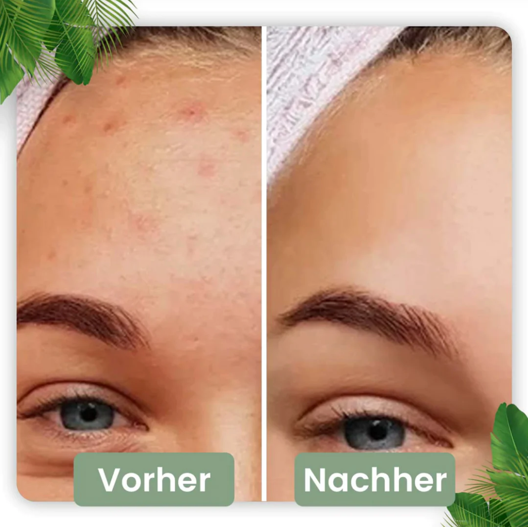 Poren Tiefenreinigungs-Maske Stick I Grüner Tee-Extrakt 1 4