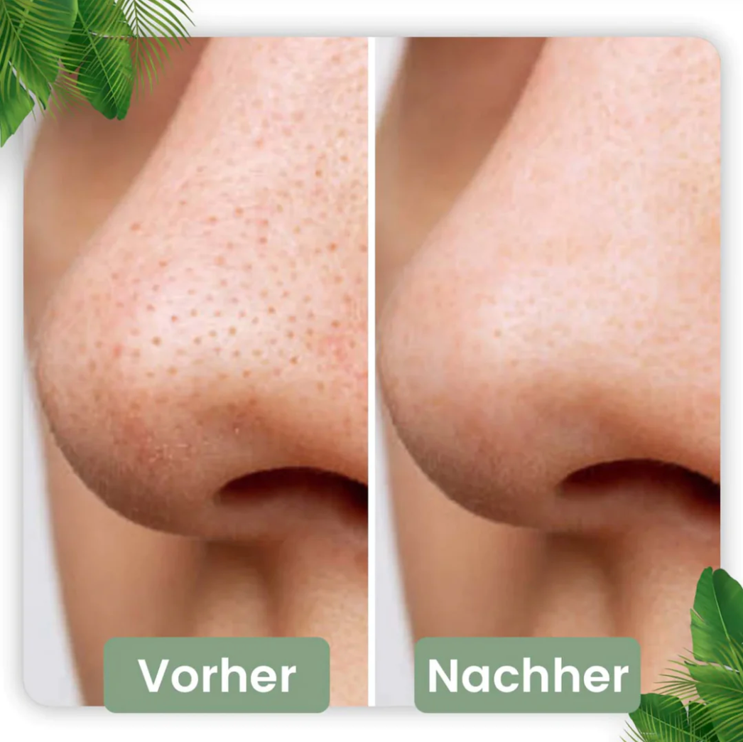 Poren Tiefenreinigungs-Maske Stick I Grüner Tee-Extrakt 1 6