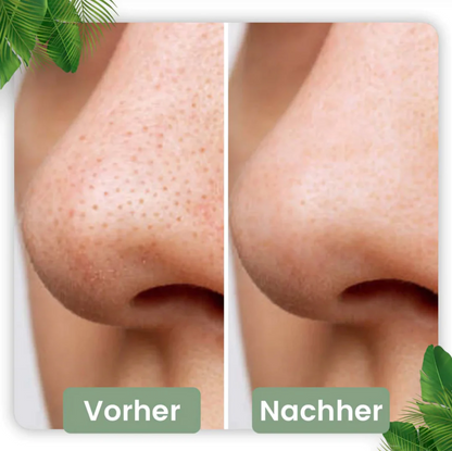 Poren Tiefenreinigungs-Maske Stick I Grüner Tee-Extrakt 1 6